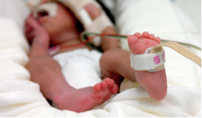 Dual SpO2 for Neonatal